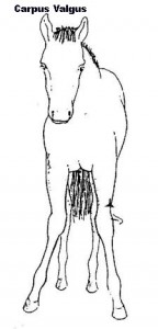 ALD Valgus